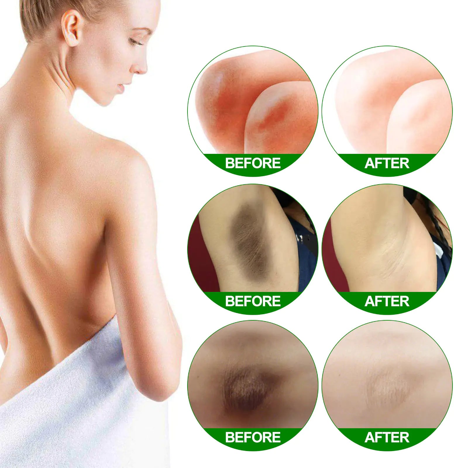 Creme EELHOE para Clareamento e Hidratação da Pele